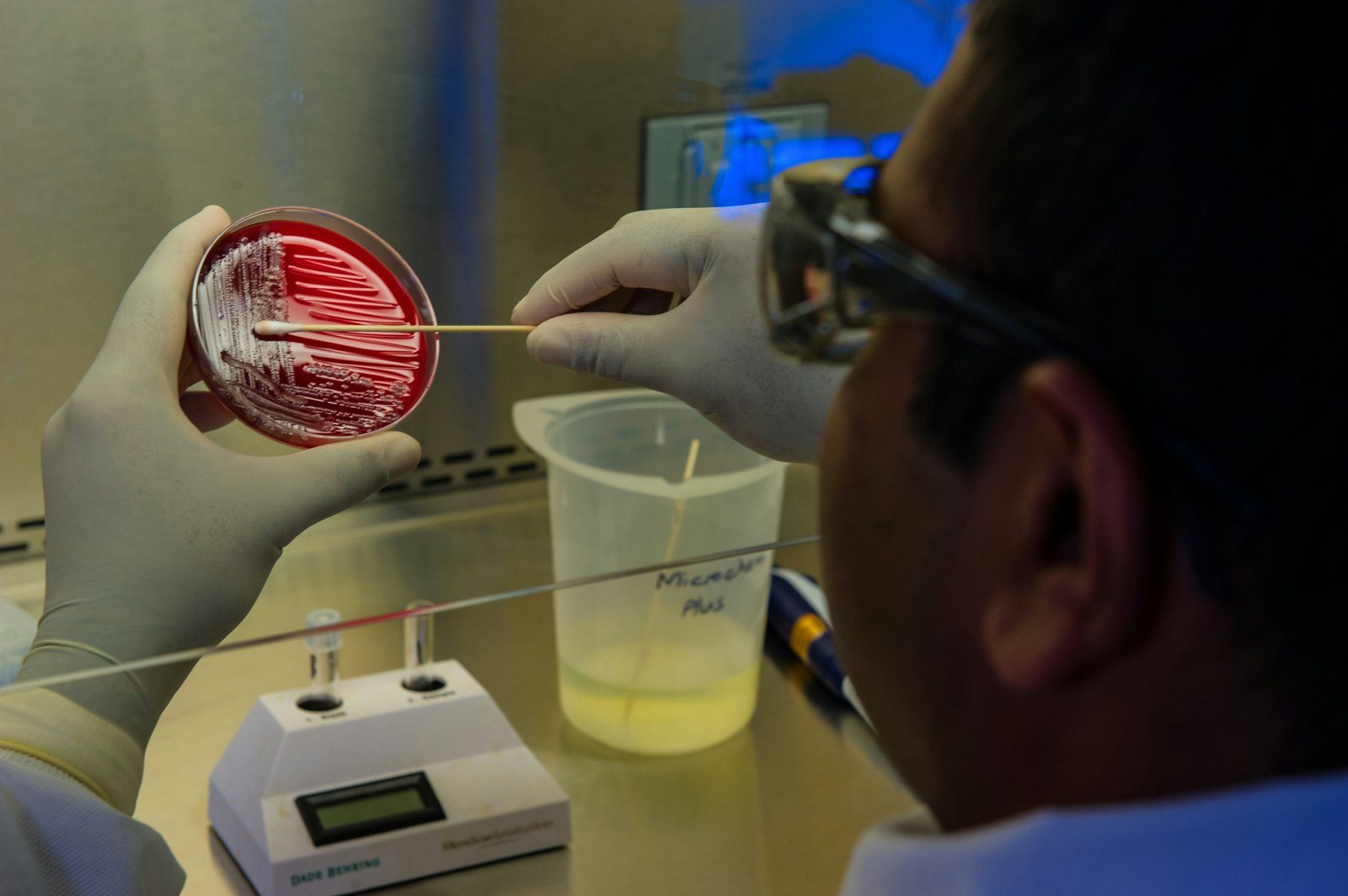 Microbiología y medios de cultivo
